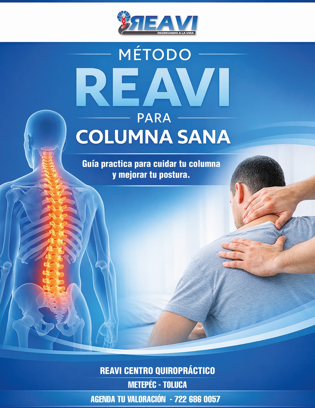 M&eacute;todo REAVI para columna sana.